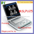 MSLPU25M Promotion Cheap Laptop ultrasound machine doppler ultrasound machine price